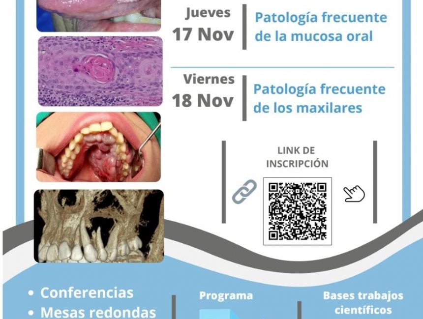 Congreso Nacional de la Sociedad de Patología Bucomáxilofacial de Chile 2022